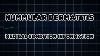 Nummular dermatitis Medical Condition [upl. by Aiciram440]