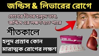 urso 300 tablet bangla  ursodeoxycholic acid tablets ip 300 mg  আরসো ৩০০ [upl. by Bonner622]