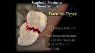 Scaphoid Fractures Blood Supply  Everything You Need To Know  Dr Nabil Ebraheim [upl. by Ysnil]