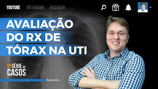 RADIOGRAFIA DE TÓRAX NA UTI  O QUE O MÉDICO PRECISA SABER [upl. by Rudin218]