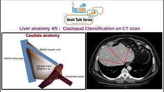 Liver segments CT  Liver anatomy  Caudate anatomy  liver imaging  Understanding CT scan [upl. by Netsruk]