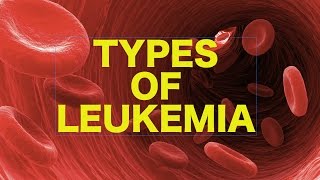 Leukemia  USMLE [upl. by Yedrahs]