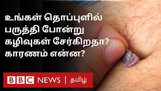 தொப்புள் குப்பை உங்க தொப்புளில் திடீரென இப்படி பஞ்சு போன்ற கழிவுகள் வர என்ன காரணம்  Belly Button [upl. by Bilow]