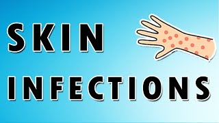 Common Skin Infections [upl. by Fabiolas]