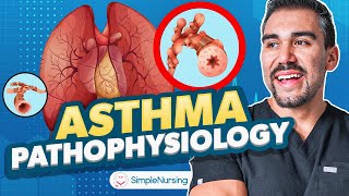 Asthma Symptoms Treatments Diagnostics Nursing  Peak Expiratory Flow Rate [upl. by Nessim]