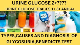 GLUCOSE SUGAR IN THE URINEBENEDICTS TESTGLUCOSE OXIDASE REAGENT STRIPSGLUCOSE 1GLUCOSE TRACES [upl. by Boot]