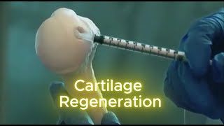 Revolutionary CARTILAGE Regeneration Tech Thats Changing Lives [upl. by Eelyrag]