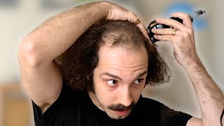 BALDING MAN Shaves Head Totally BALD amp Looks AMAZING [upl. by Notrom682]