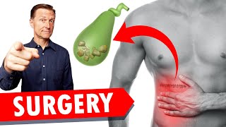 Gallbladder Surgery Removal WATCH THIS [upl. by Pepper]