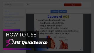 EM QuickSearch Feature Overview  The National EM Board Review Course [upl. by Clary]