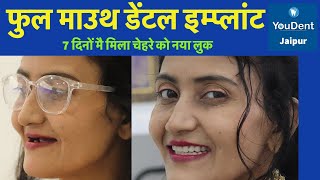 डेंटल इंप्लांट से सिर्फ़ सात दिनों में बदला चेहरे का look ॥ Successful Dental Implant in 7 days ॥ [upl. by Nylecoj]