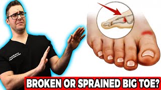 Broken Big Toe or Sprained Big Toe Joint BEST Home Treatment 2022 [upl. by Vina]