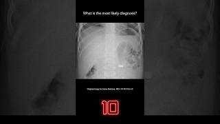 Abdominal Xray Question 5 [upl. by Benenson]