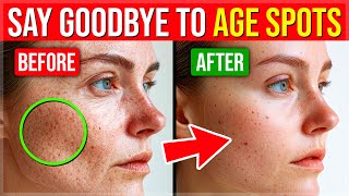 9 Proven BEST Ways To GET RID Of Pesky AGE SPOTS [upl. by Madalena610]