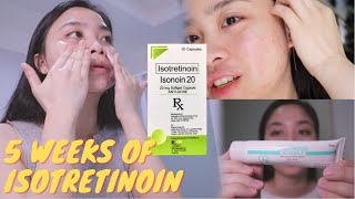 🌜MY NIGHT TIME SKINCARE ROUTINE with Tretinoin  5 WEEKS Isotretinoin Update 🌛 [upl. by Sosthina113]