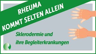 Rheuma kommt selten allein Systemische Sklerodermie und ihre Begleiterkrankungen [upl. by Enelahs538]