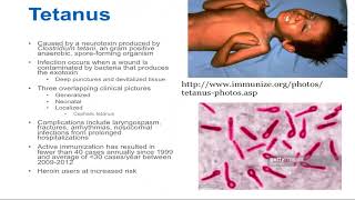 Tetanus  Epidemiology and Associated Complications [upl. by Alaikim]