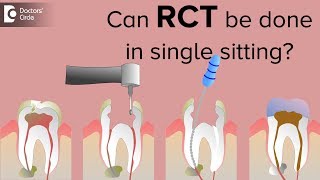 Can patients finish of RCT in single sitting  Dr Ramakrishna T [upl. by Ebba]