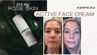 Adipeau Active Face Cream Review by a Licensed Esthetician [upl. by Atiuqrehs]