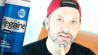 ICH MACHE VOLLBART 🧔🏻– WARUM WIE WOMIT Ich starte mein MINOXIDIL BART EXPERIMENT mit REGAINE – GY [upl. by Yelrahc]