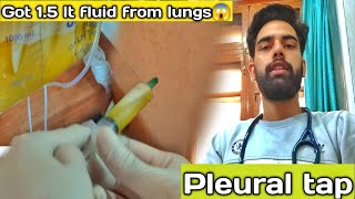 Beyond the Diagnosis Exploring Pleural Effusion Treatment Options [upl. by Arval988]