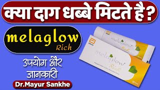 Melaglow cream usage benefits amp side effects  Detail review in hindi by DrMayur  Skin whitening [upl. by Ardnaxila]