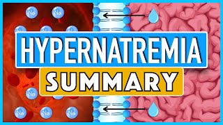 Hypernatremia Summary [upl. by Bohner]