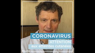 Coronavirus  quels sont les signes cutanés de linfection [upl. by Calderon]