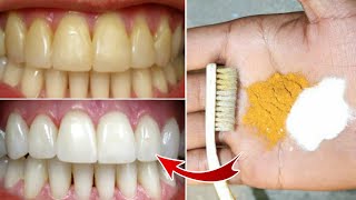 Magical Teeth Whitening home Remedy Get whiten Teeth at home in 3 minutes [upl. by Ika641]