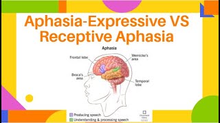 AphasiaExpressive VS Receptive Aphasia  Fluent amp NonFluent Aphasia  PhysiotherapyKnowledge [upl. by Lundt]