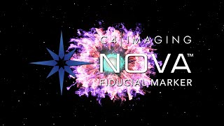 Innovation in Cancer Care NOVA Fiducial Markers Unveiled by Leading Physicians [upl. by Egon140]