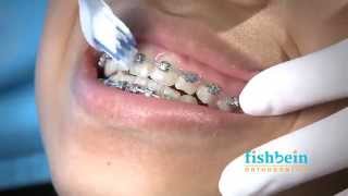 Orthodontic Home Care Instructions  Braces  Brushing [upl. by Ardnoel]