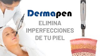 ¿Qué es el Dermapen  Conoce el tratamiento que cambiará tu piel [upl. by Betthezel]