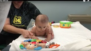 BABY GETS PHYSICAL THERAPY FOR TORTICOLLIS [upl. by Marston]