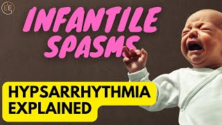 The Terrifying Truth About Infantile Spasms [upl. by Bryant]