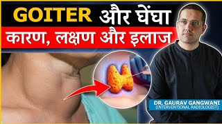 Important Things To Know About Thyroid Goiter  Dr Gaurav Gangwani Interventional Radiologist [upl. by Rubel]