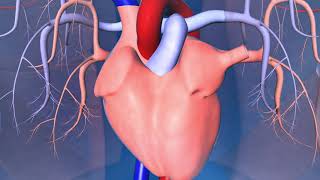 Catheter Ablation What is it and how does it help an irregular heart beat [upl. by Junji]