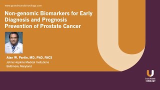 Non genomic Biomarkers for Early Diagnosis and Prognosis Prevention of Prostate Cancer [upl. by Eiger]