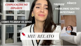 O QUE A DOENÇA DO SILICONE FEZ NA MINHA VIDA  MEU RELATO PT 2 [upl. by Aeli158]