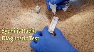 How To Use Syphilis Rapid Diagnostic Test  VDRL Test [upl. by Kier793]