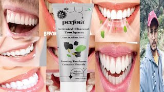 Perfora Activated Charcoal Toothpaste  Honest Review [upl. by Alyal]