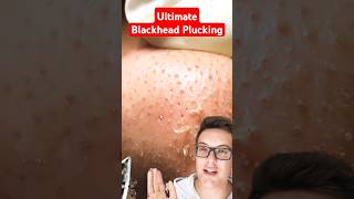 Crazy Satisfying BLACKHEAD PLUCKING  You Will Love This shorts [upl. by Ayisan843]