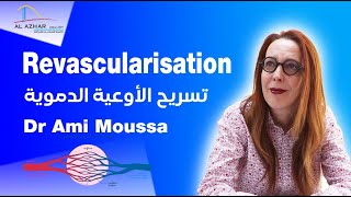 Chirurgie Vasculaire  Revascularisation avec le Dr Ami Moussa  تسريح الأوعية الدموية [upl. by Nannoc]