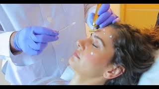 Botulinum toxin type A  Ozge Ergun MD  Plastic Surgery  Istanbul [upl. by Carlita382]