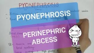 PYONEPHROSIS  PERINEPHRIC ABCESS [upl. by Everett]