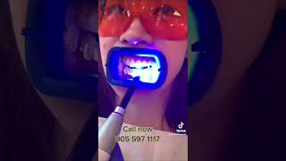 Zoom teeth whitening [upl. by Enyalb108]