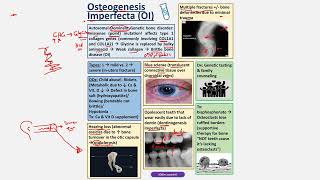 Osteogenesis Imperfecta CBL [upl. by Nwatna891]