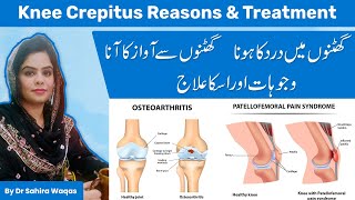 Knee crepitus  Knee popping noise  Ghutno sa awaz ka aana  By Dr Sahira Waqas [upl. by Shelton369]