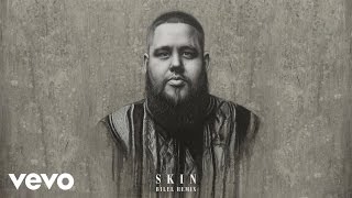 RagnBone Man  Skin Bilel Remix Audio [upl. by Ehrenberg]