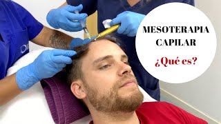 MESOTERAPIA CAPILAR ¿Qué es [upl. by Macey]